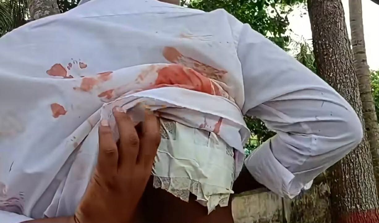 ফেনীর ছাগলনাইয়া খাতা না দেখানোয় এসএসসি পরীক্ষার্থীকে ছুরিকাঘাত