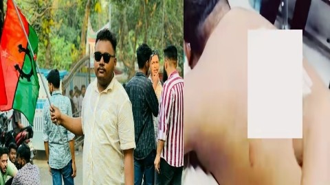 মহিপাল সরকারি কলেজ ছাত্রদলের সাধারণ সম্পাদককে ছুরিকাঘাত, গুরুতর আহত 